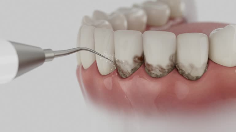 Reliable Dental Implants contractor in Verandah, FL by Smile Center Dentistry